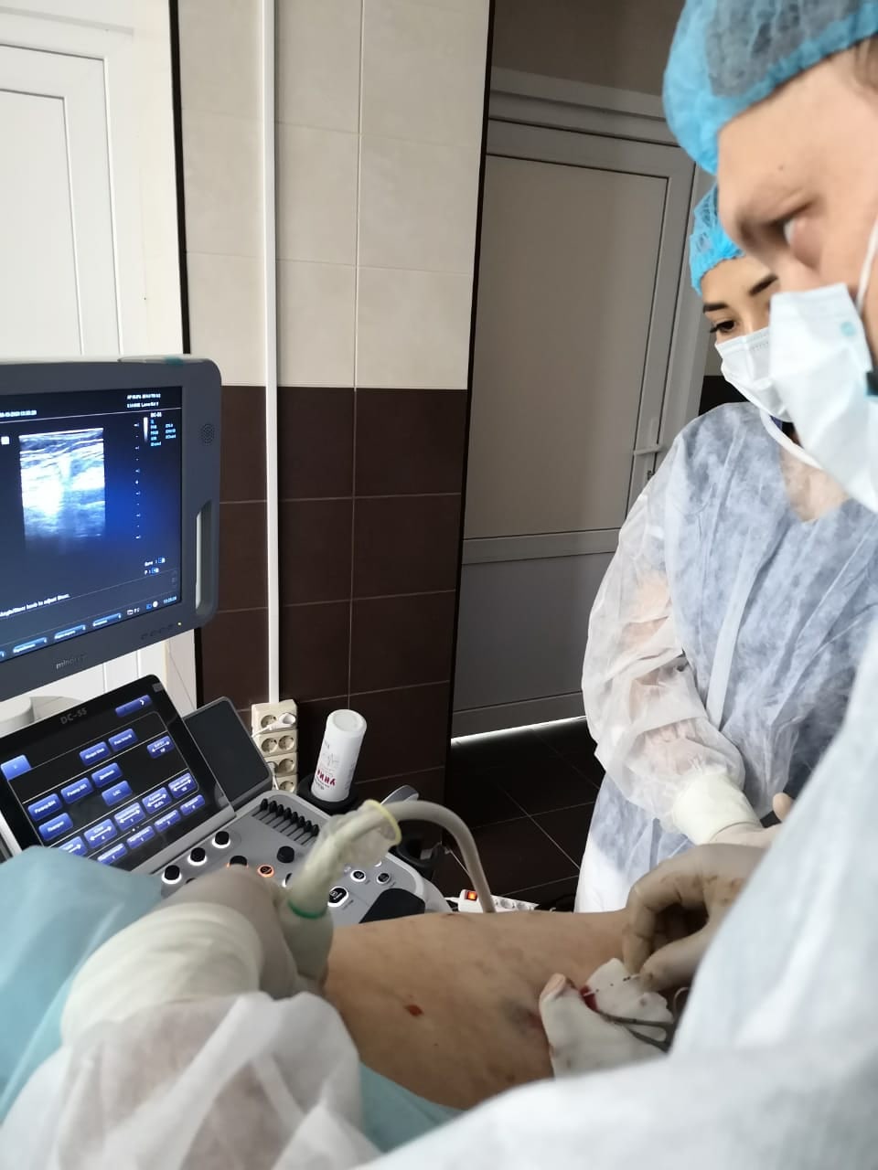 Операция выполняется только с УЗИ контролем