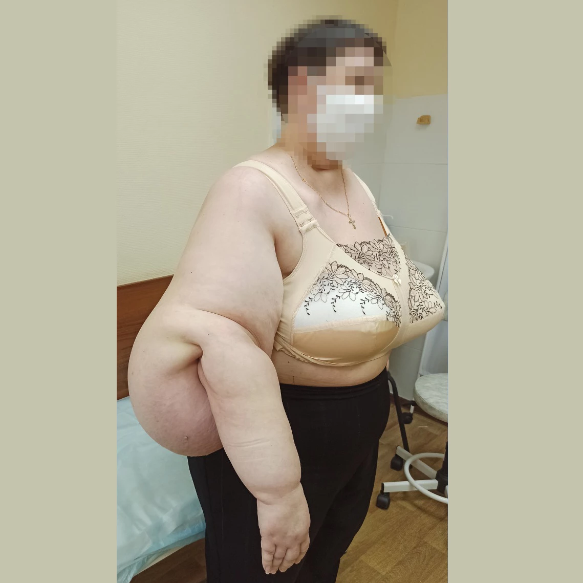 Исходный вид руки