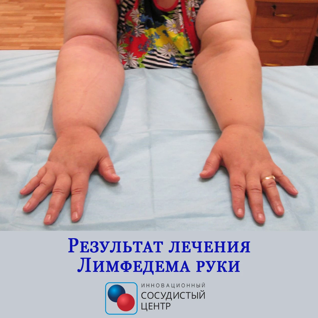 Результат через 6 месяцев